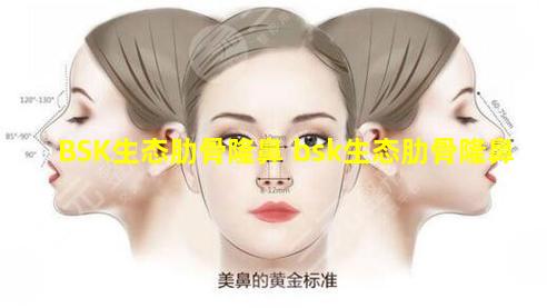 BSK生态肋骨隆鼻 bsk生态肋骨隆鼻